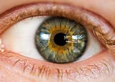 سهم 80 درصدی اپتومتریست ها در آنالیز مسائل بینایی